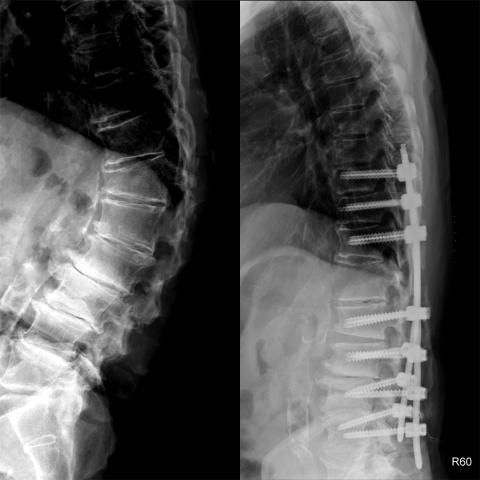 Blank 2 Grids Collage (2)